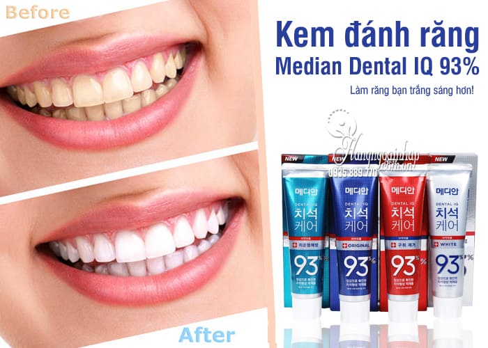 Kem đánh răng Median 93% Hàn Quốc