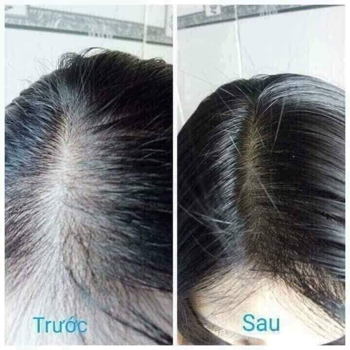 Bộ Dầu gội xã BIOTIN mỹ