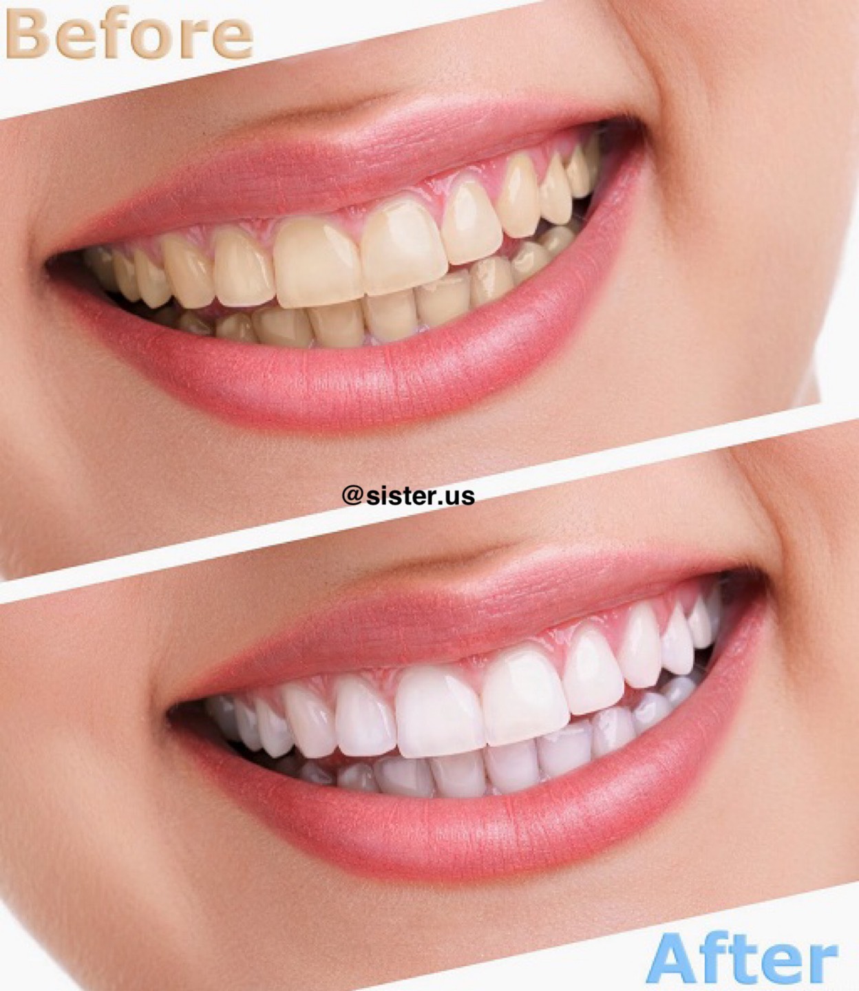 [Hàng Mỹ Nhập] Dán trắng răng CREST 3D White Whitestrips - Professional Effect ( gói lẻ)