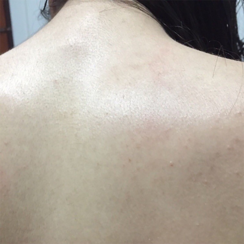 [HCM]Xịt Mụn Cơ Thể The Magic Clear Body Mist Hàn Quốc
