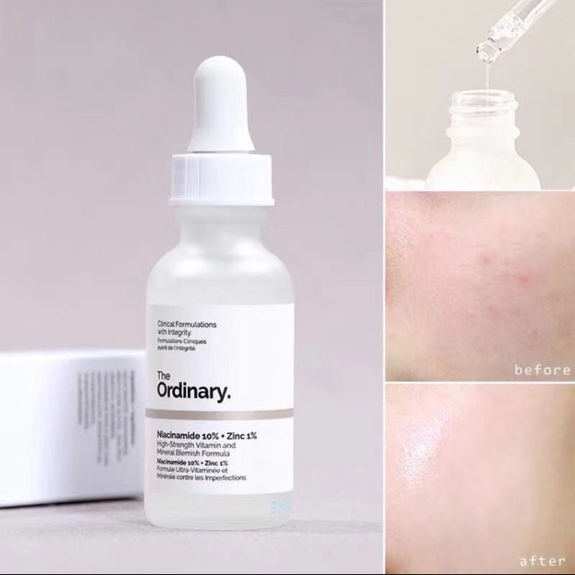 [HCM]The Ordinary Niacinamide 10% + Zinc 1% 30ml