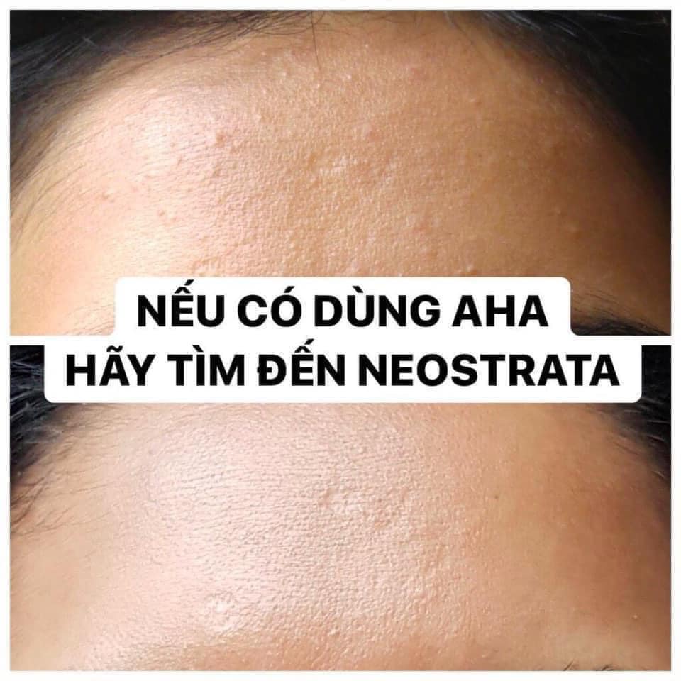 Neostrata Oily Skin Solution Lotion AHA 8% chai full 100ml (chất lỏng)