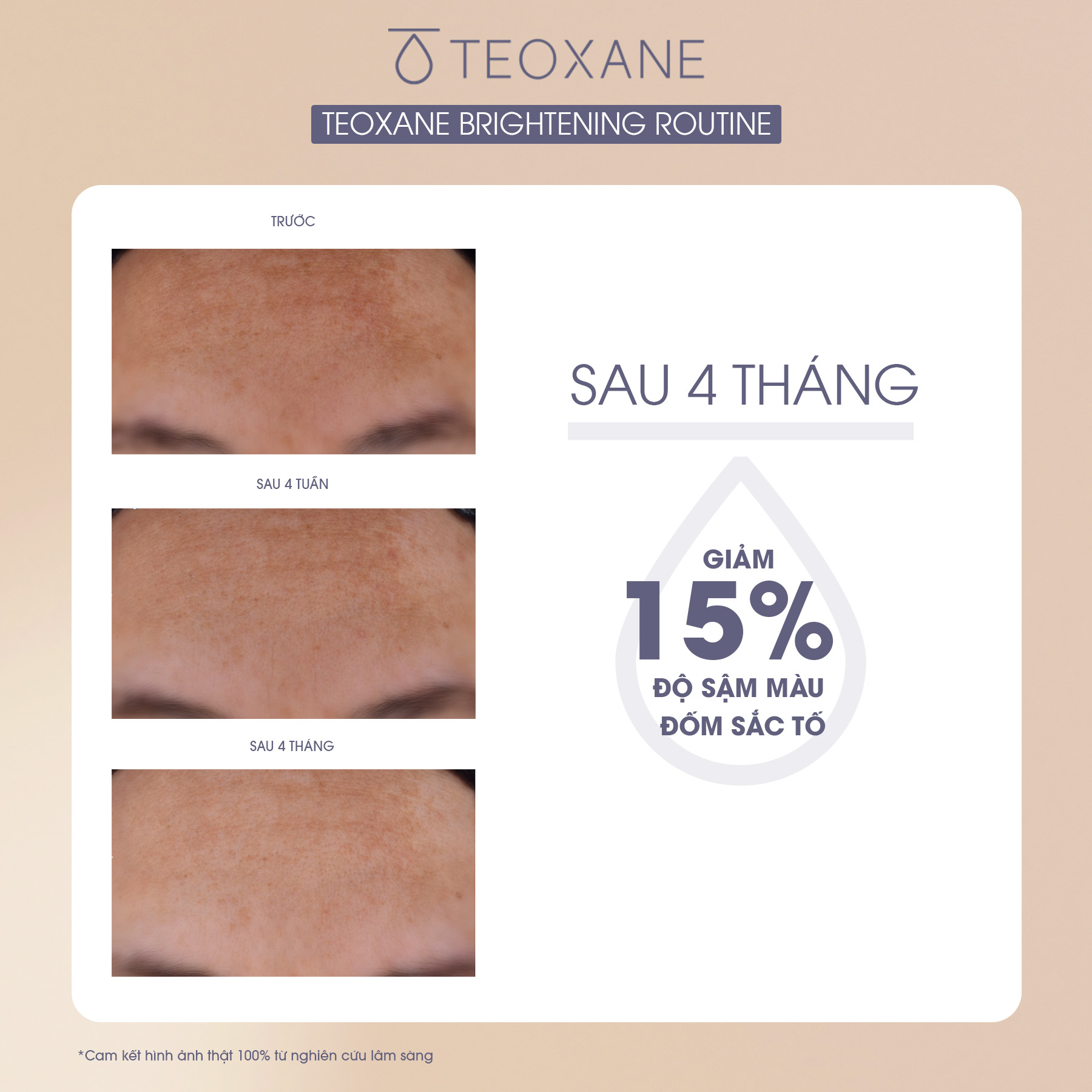 Combo RHA Vit C Serum + Kem chống Nắng Advanced Perfecting Shield SPF 50+