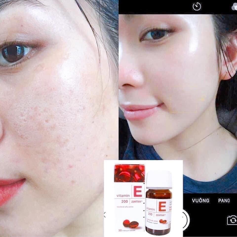 Vitamin E đỏ Nga của Mirrolla