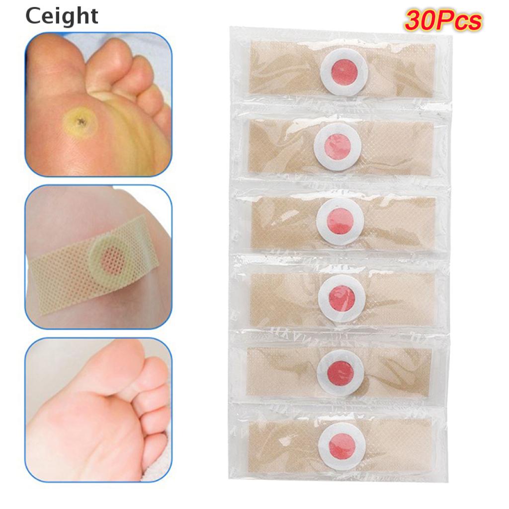 5 Miếng Dán Tẩy Mụt Cóc Nhanh Hiệu Quả Cao