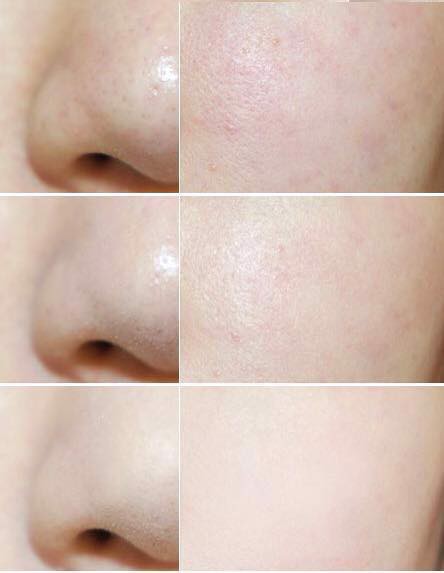 Phấn Phủ Shiseido Baby Powder Pressed 50gr