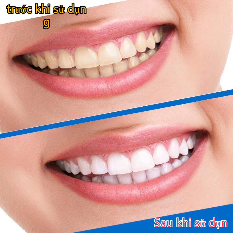 3D cool teeth whitening patch (1 bag of 2 stickers)