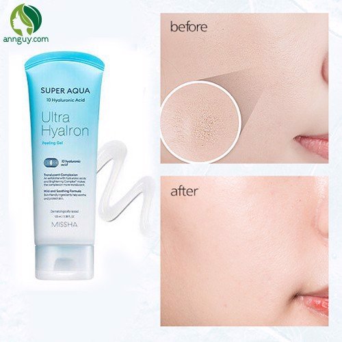 Tẩy Tế Bào Chết Missha Super Aqua Peeling Gel 100ml