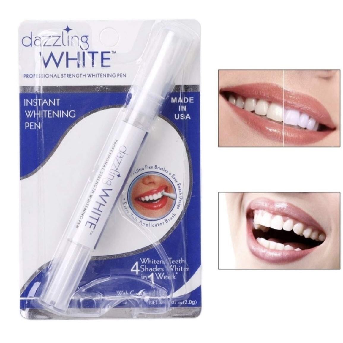 Bút trắng răng dazzling White (Hàng có sẵn)