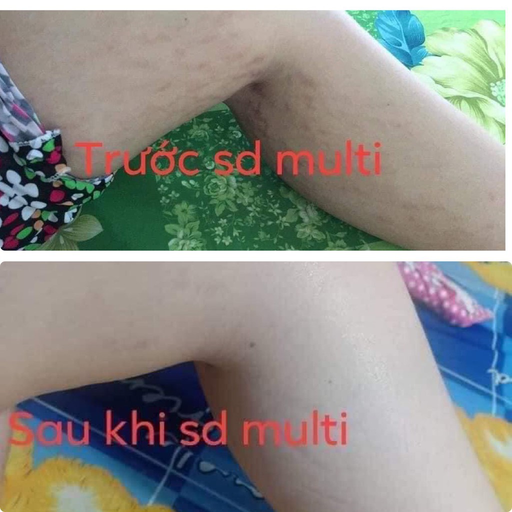 Kem rạn da Multi 16 [CHÍNH HÃNG ATHENA] hũ 20gr