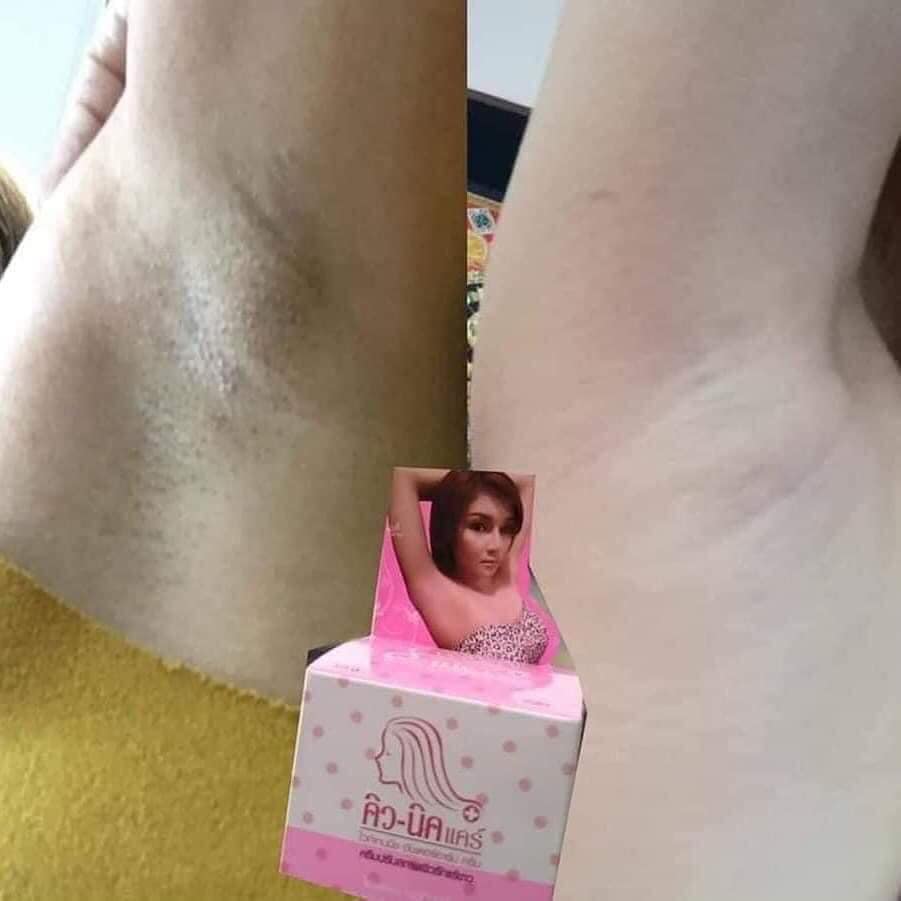 kem thâm nách hiệu quả