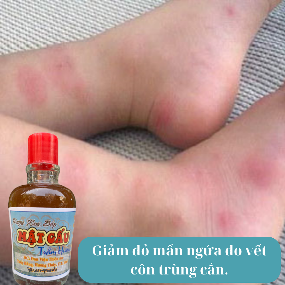 Dầu Xoa Bóp Cây Mật Gấu Thiên An