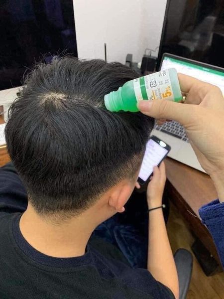 Tinh chất Sato Chấm Hói Mọc Tóc Giảm Rụng Tóc 30ml Nhật Bản - 1 Lọ