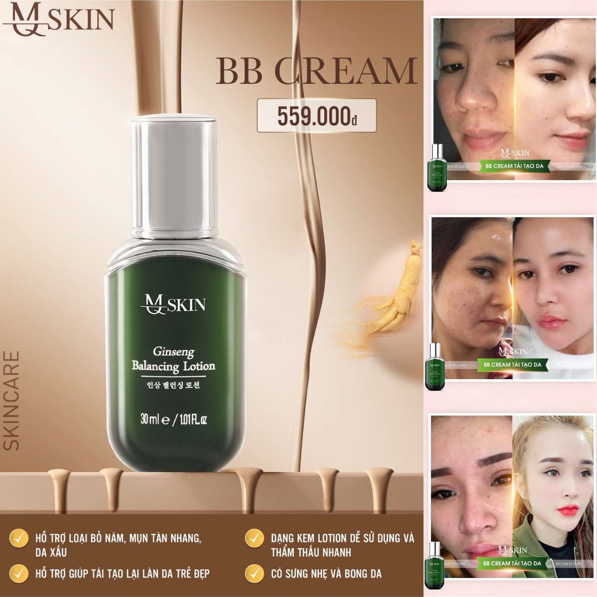 BB CREAM thay da Mq skin tái tạo dưỡng da căng bóng make up thay da chống nắng xóa nám thâm sạm da không đều màu 30ml