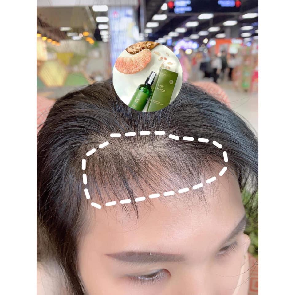 TINH DẦU XỊT BƯỞI KÍCH THÍCH MỌC TÓC VIJULY