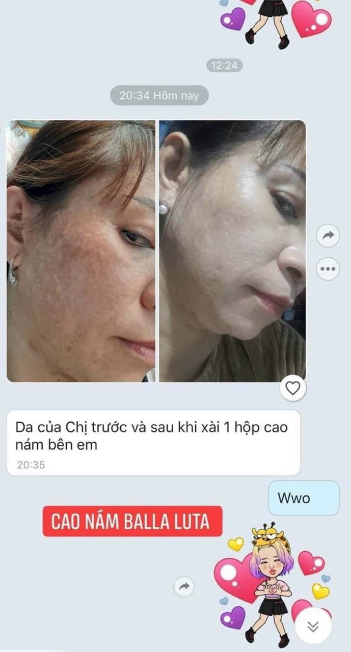 Kem face sữa cô gái núi