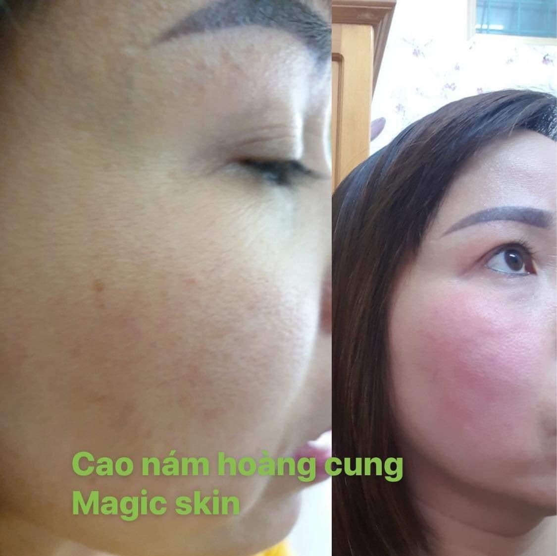 KEM CAO NAM SIZE NHO MAGIC SKIN