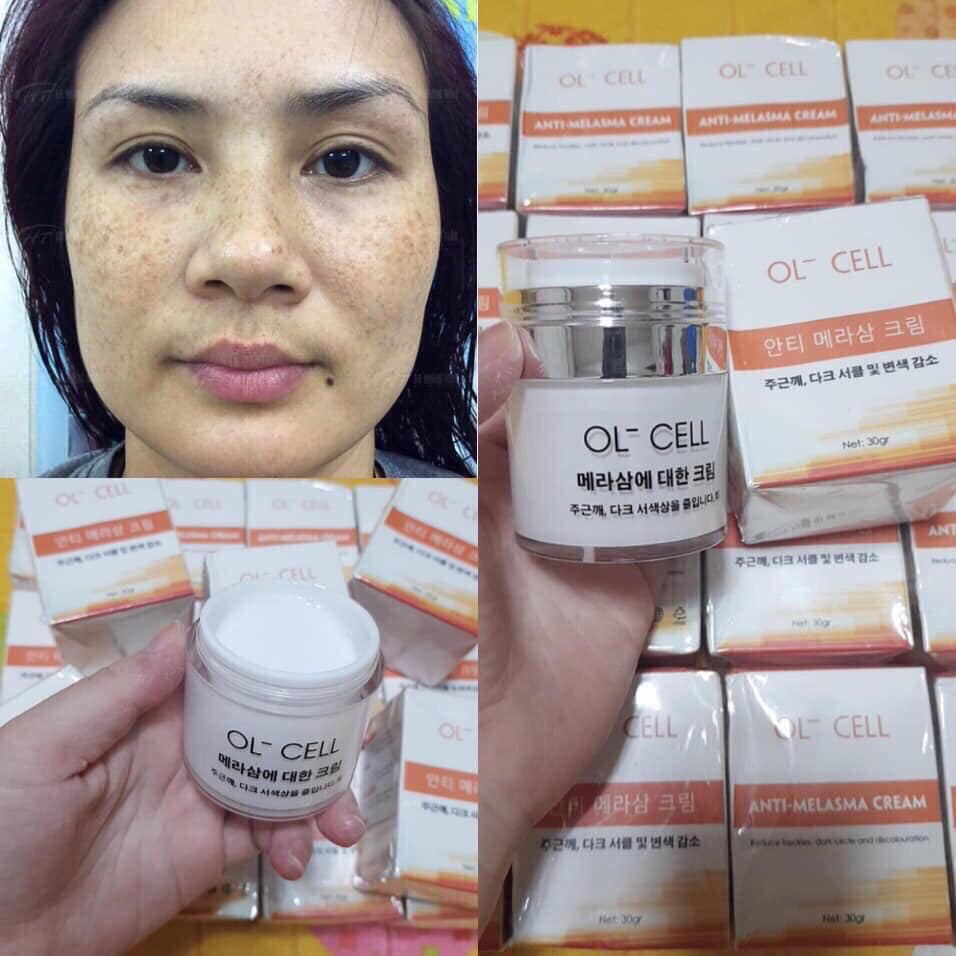 Kem Hút Nám Tàn Nhang Ol Cell ( rất tốt, cam kết chuẩn 100%)