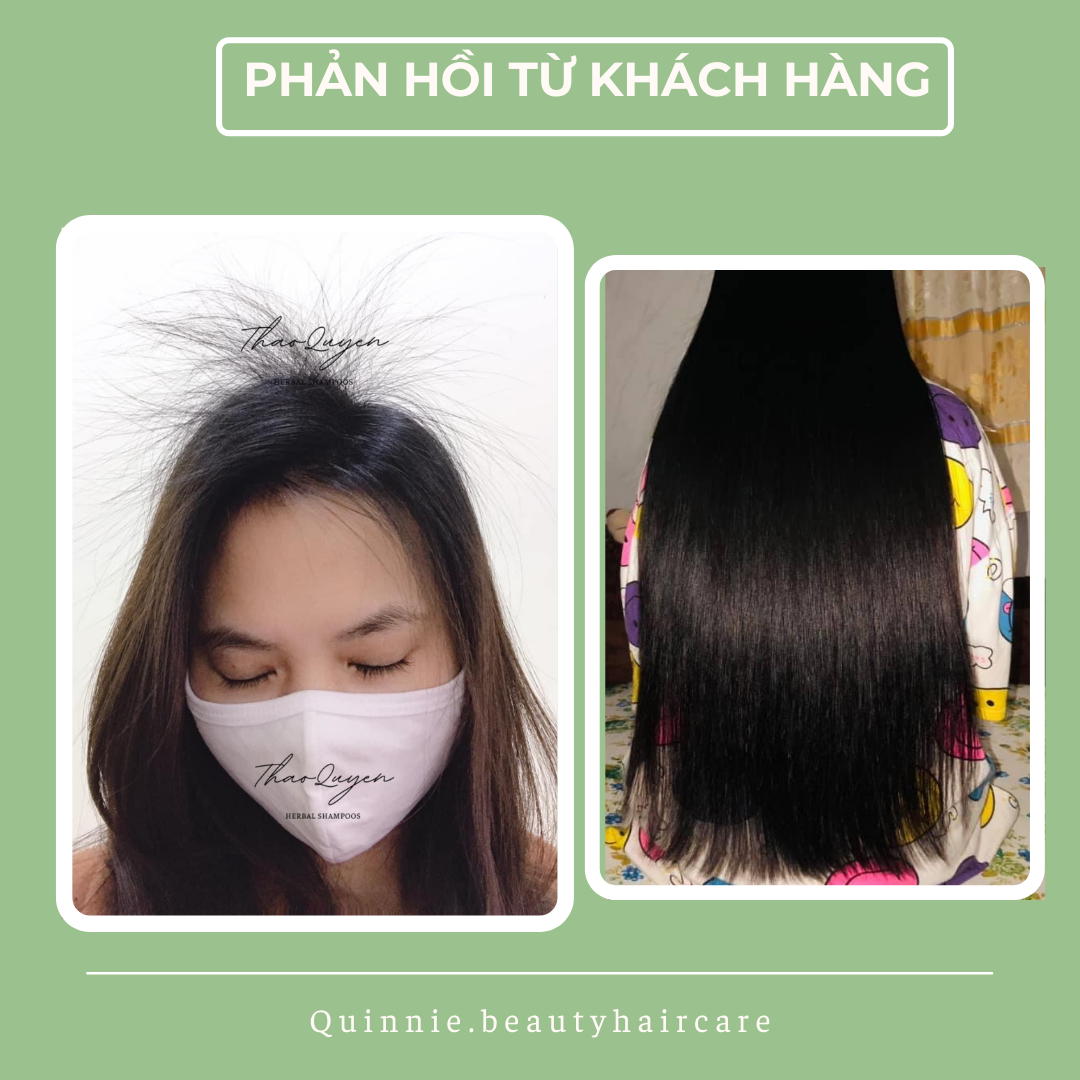 DẦU GỘI BỒ KẾT- GIẢM RỤNG TÓC & KÍCH THÍCH MỌC TÓC- 250ML
