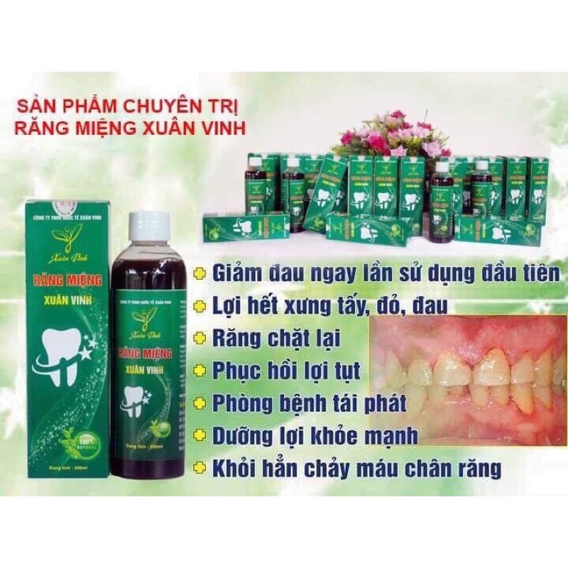 Nước Súc Miệng Thảo Dược Xuân Vinh 200ml