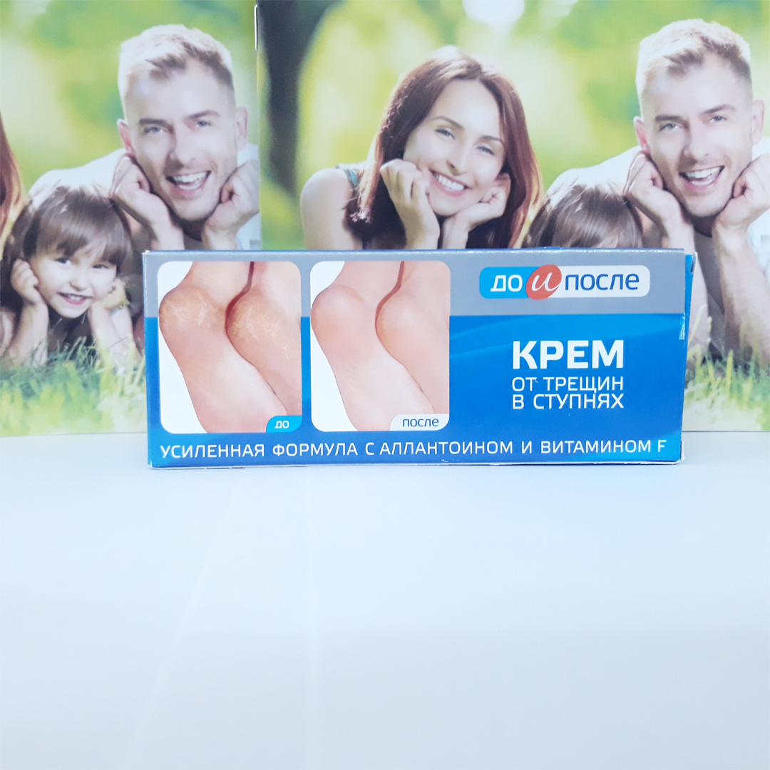 [ Hàng Chính Hãng] Kem Nứt Gót Chân Kpem Nga 50ml