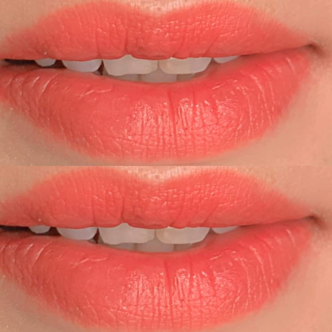 MIẾNG DÁN MÔI bela looại 1 của đức hộp 12 miếng