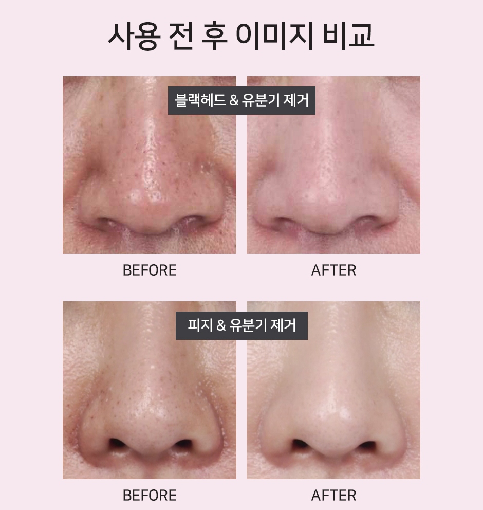 Tẩy da chết Neogen Pore Tight Peeling Mousse
