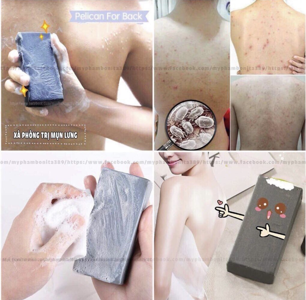 Xà Phòng Ngừa Mụn Lưng For Back