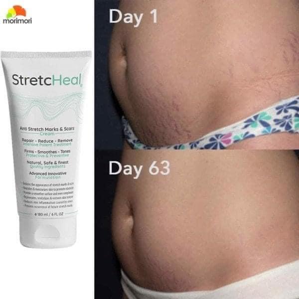 [GIẢM 5% ĐƠN 129K]Kem dưỡng da rạn StretcHeal