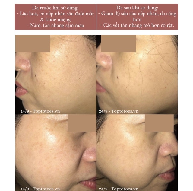 Serum Bielenda Retinol Neuro/ Mezo Skin Clinic trẻ hoá làm da căng bóng mờ thâm sẹo