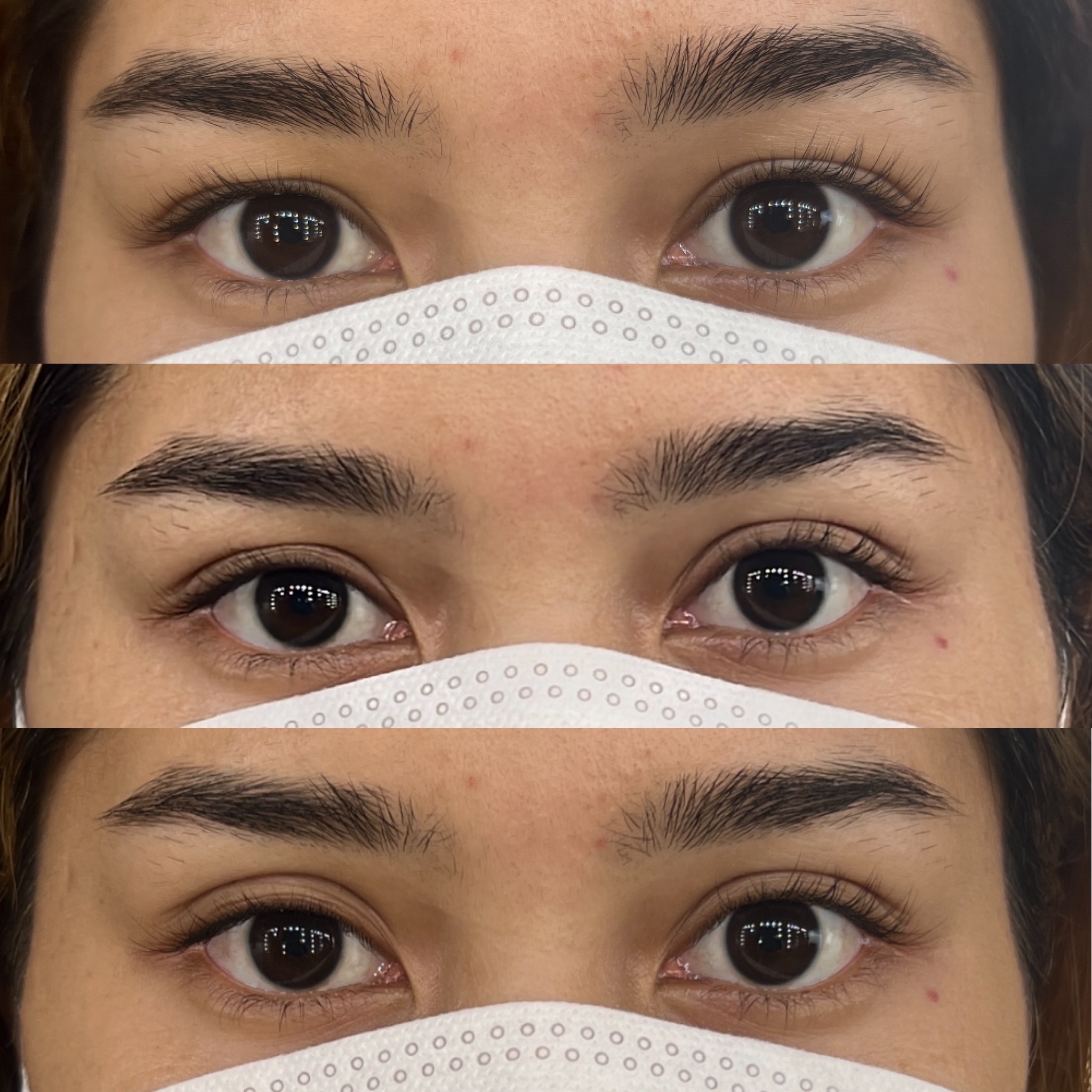 Invisible Eyelid tape ( miếng dán kích mí tàng hình)