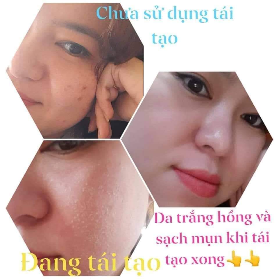 Tinh chất tái tạo da HUỲNH ĐỖ