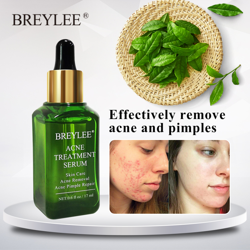 BREYLEE Acne Treatment Serum 17ml Tea Tree Oil Anti Acne Skin Care Acne Scar Remover Oil Control cao cấp