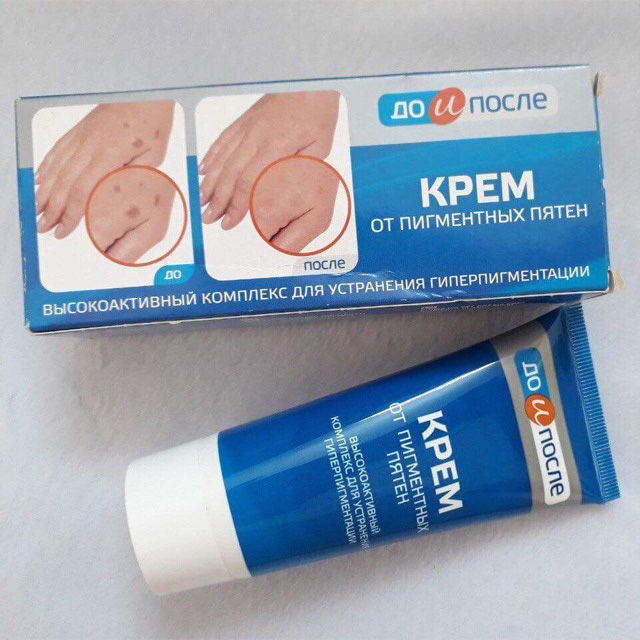 Kem  đồi mồi Nga