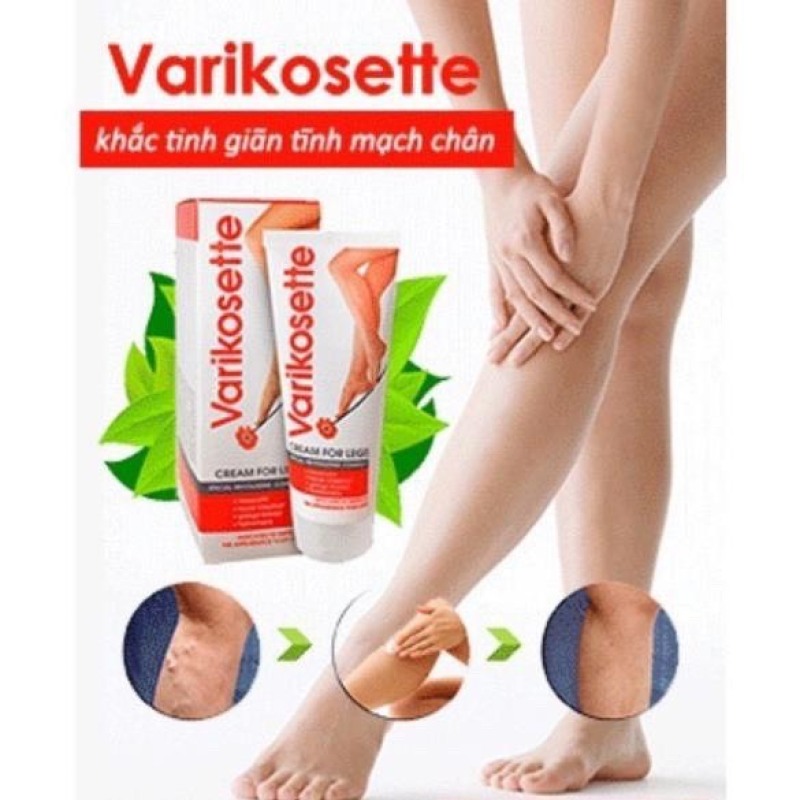 Kem bôi hỗ trợ điều trị giãn tĩnh mạch chân Verikostte 75ml