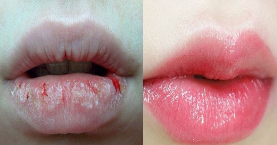 Son dưỡng môi dạng thỏi Vaseina
