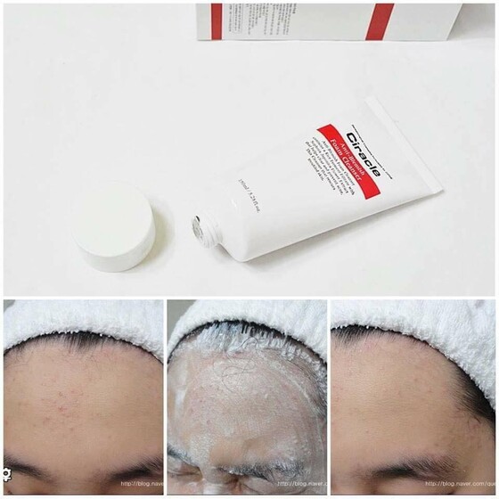 Sữa Rửa Mặt Ciracle Anti Blemish Foam Cleanser