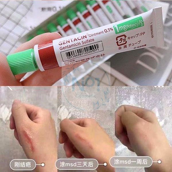 Kem làm mờ sẹo Gentacin Nhật Bản 10g