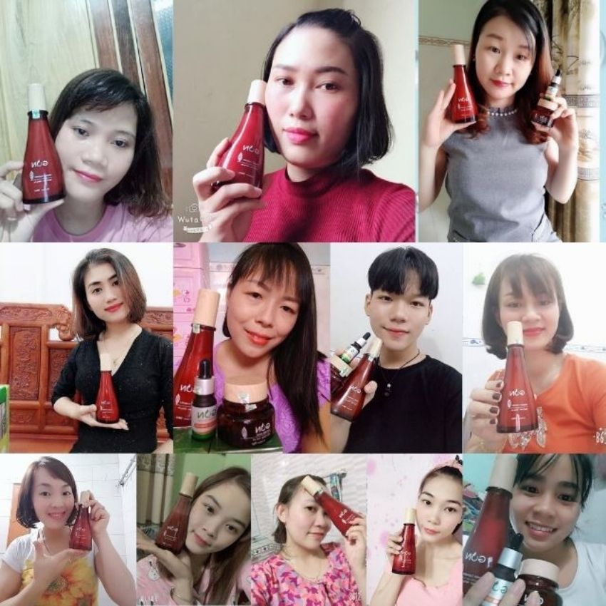 [Chính Hãng] Sữa rửa mặt Gon Sạch Mụn - Sáng da