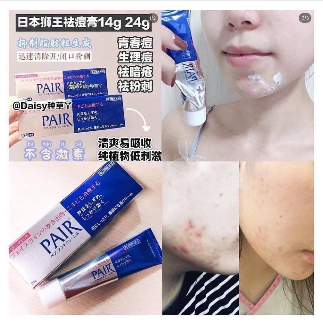 Kem ngừa mụn Pair Acne W Cream Nhật Bản