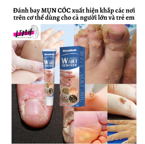 {ĐÁNH BẬT} Mụn Cóc, Mụn Thịt Remove Every Warts