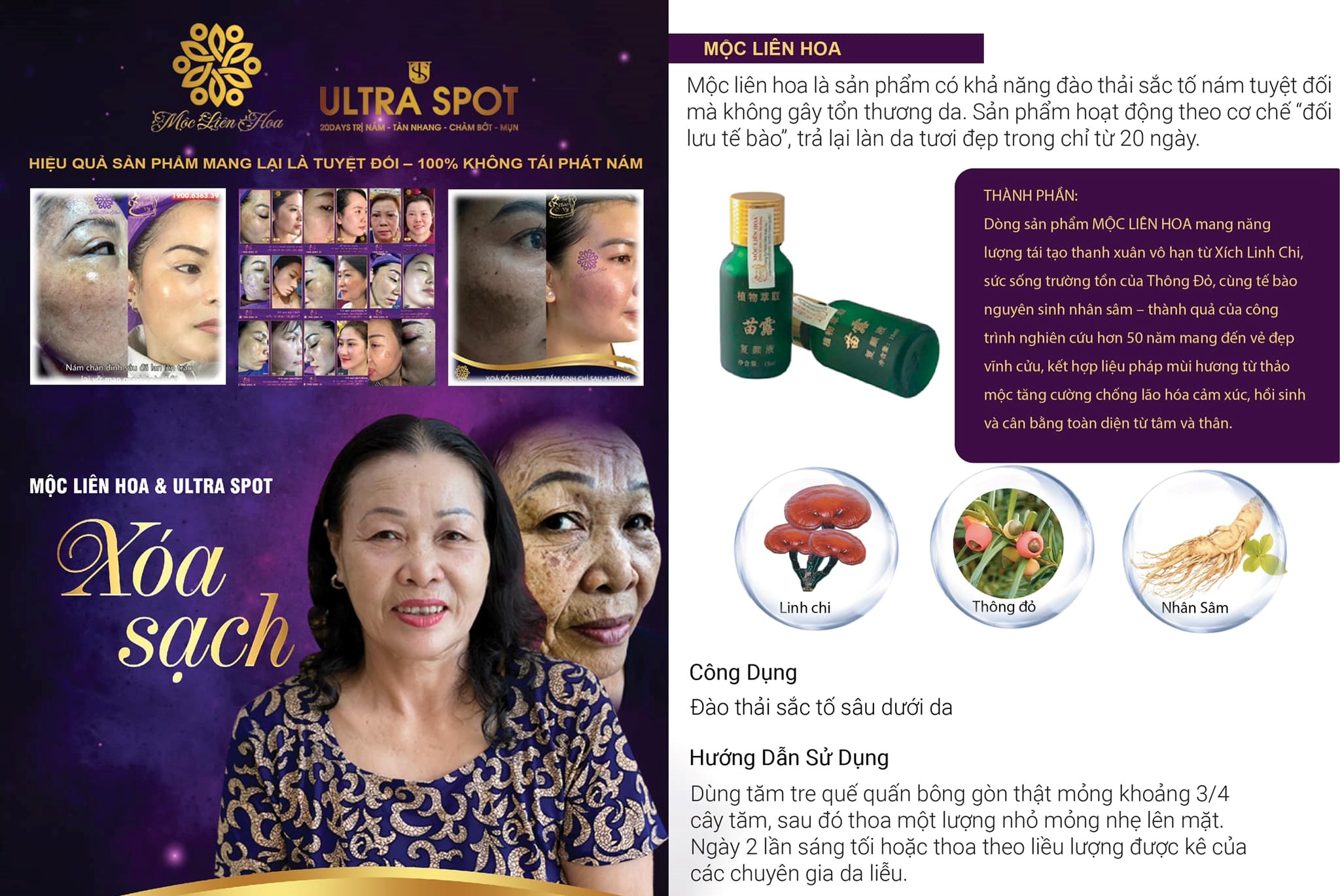 Mộc Liên Hoa - Serum đào thải nám tàn nhang