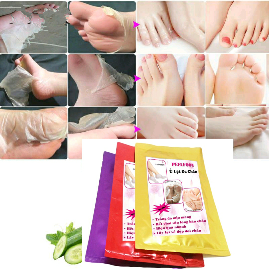 [HCM]Feelfoot Lột Trắng Da Chân Hết Chai Sần