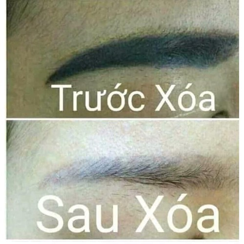 [HCM]Xóa xăm CS LAB Hàn Quốc chân mày phun xăm