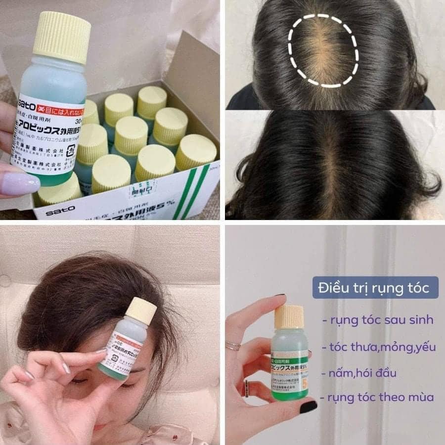 Tinh Chất Kích Thích Mọc Tóc Thảo Dược Nhật Bản Sato / Choise Arovics Solution 5%