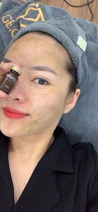 DERMAPEEL TRỨNG CÁ TUYẾT HÀN QUỐC