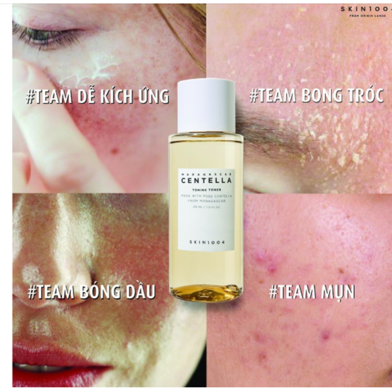 Nước hoa hồng Skin1004 - Toner Rau Má Madagascar Centella Toning phục hồi, tái tạo da nhạy cảm 210ml