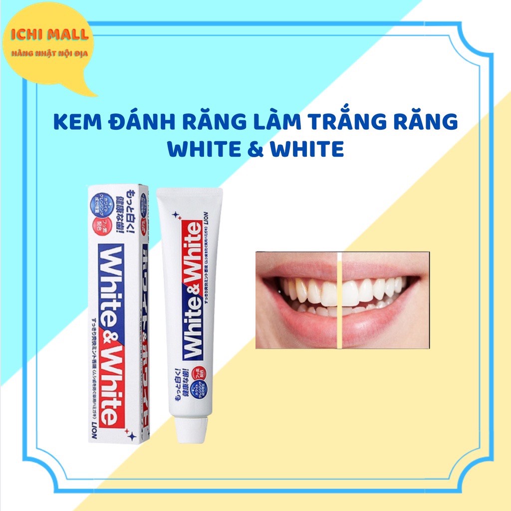 KEM ĐÁNH RĂNG LÀM TRẮNG RĂNG WHITE & WHITE