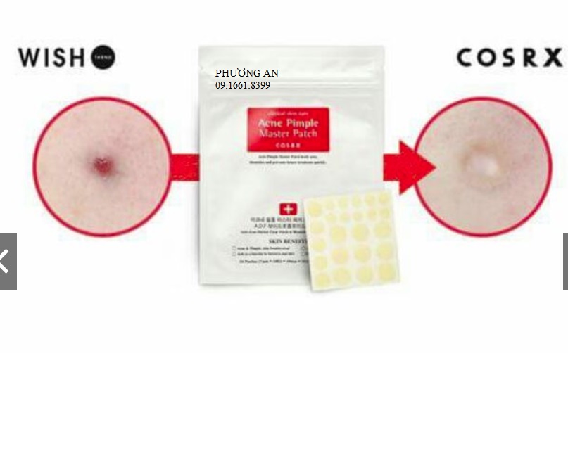 Miếng Dán Mụn Corsx - Acne Pimple Master Patch Cosrx CHÍNH HÃNG