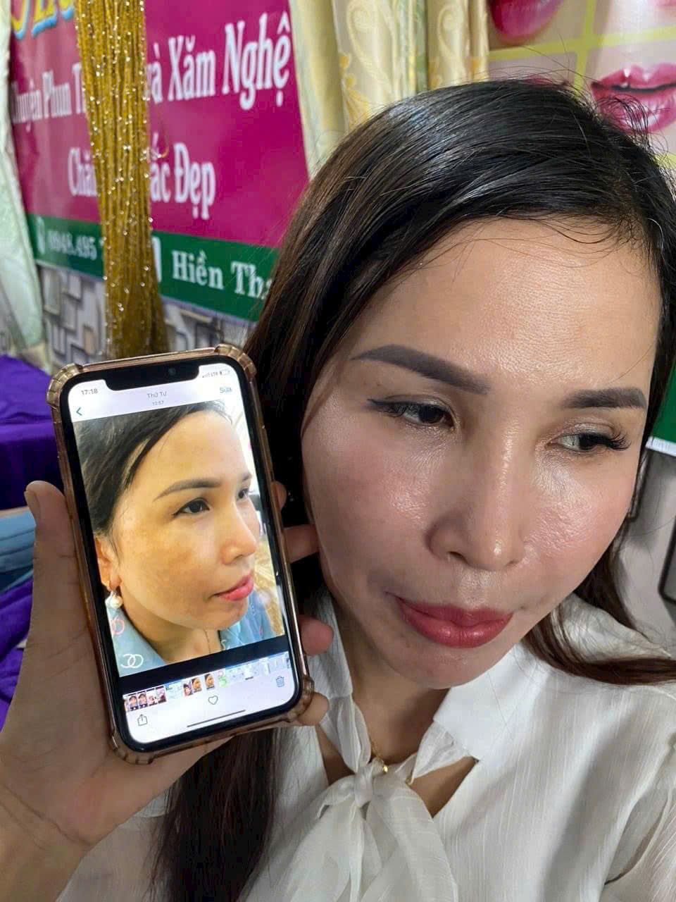 [Chính Hãng].Chấm Tàn Nhang không đau rát Yody Phương Anh dạng gel phù hợp với mọi loại da